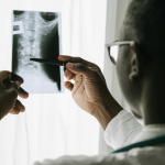 A person in a white coat examines and points at a spinal X-ray film held up to the light, highlighting concerns about spinal cord damage from auto wrecks and the potential lifetime care costs involved. - Ghassemi Law Group A person in a white coat examines and points at a spinal X ray film held up to the light, highlighting concerns about spinal cord damage from auto wrecks and the potential lifetime care costs involved