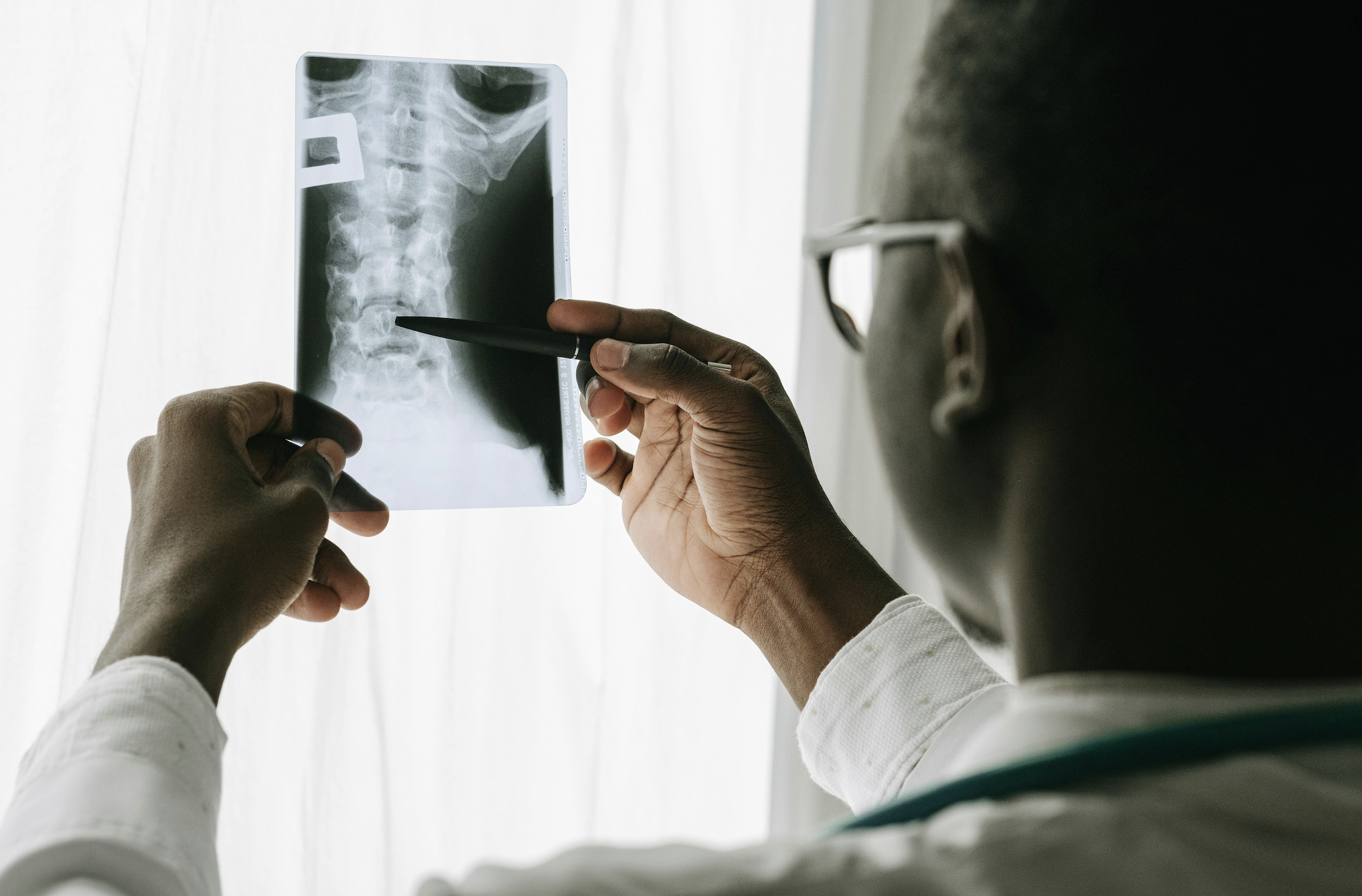 A person in a white coat examines and points at a spinal X-ray film held up to the light, highlighting concerns about spinal cord damage from auto wrecks and the potential lifetime care costs involved. - Ghassemi Law Group A person in a white coat examines and points at a spinal X ray film held up to the light, highlighting concerns about spinal cord damage from auto wrecks and the potential lifetime care costs involved