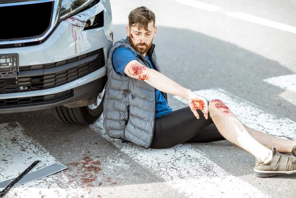 A man with bleeding injuries sits on a crosswalk next to a vehicle with visible blood stains, suggesting a recent accident. - Ghassemi Law Group A man with bleeding injuries sits on a crosswalk next to a vehicle with visible blood stains, suggesting a recent accident.